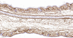 Collagen VI Antibody in Immunohistochemistry (Paraffin) (IHC (P))