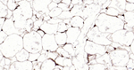 Perilipin 1 Antibody in Immunohistochemistry (Paraffin) (IHC (P))