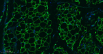Perilipin 1 Antibody in Immunohistochemistry (Paraffin) (IHC (P))