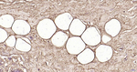 Perilipin 1 Antibody in Immunohistochemistry (Paraffin) (IHC (P))