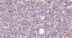 Perilipin 1 Antibody in Immunohistochemistry (Paraffin) (IHC (P))