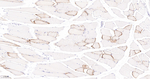 Aquaporin 4 Antibody in Immunohistochemistry (Paraffin) (IHC (P))