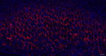 Aquaporin 4 Antibody in Immunohistochemistry (Paraffin) (IHC (P))