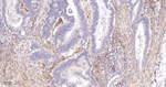 PDGFRB Antibody in Immunohistochemistry (Paraffin) (IHC (P))