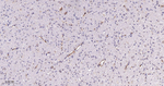 PDGFRB Antibody in Immunohistochemistry (Paraffin) (IHC (P))