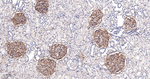 PDGFRB Antibody in Immunohistochemistry (Paraffin) (IHC (P))