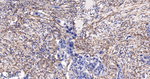 PDGFRB Recombinant Rabbit Monoclonal Antibody (3A3)