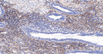 PDGFRB Antibody in Immunohistochemistry (Paraffin) (IHC (P))