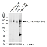 PDGFRB Antibody in Western Blot (WB)