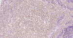 ULK1 Antibody in Immunohistochemistry (Paraffin) (IHC (P))