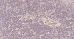 ULK1 Antibody in Immunohistochemistry (Paraffin) (IHC (P))