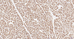 ULK1 Antibody in Immunohistochemistry (Paraffin) (IHC (P))