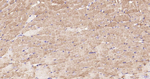 ULK1 Antibody in Immunohistochemistry (Paraffin) (IHC (P))