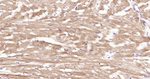 ULK1 Antibody in Immunohistochemistry (Paraffin) (IHC (P))