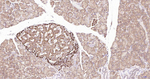 ULK1 Antibody in Immunohistochemistry (Paraffin) (IHC (P))
