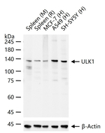 ULK1 Antibody in Western Blot (WB)