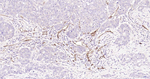 CD105 Antibody in Immunohistochemistry (Paraffin) (IHC (P))