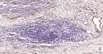 CD105 Antibody in Immunohistochemistry (Paraffin) (IHC (P))