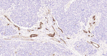 CD105 Antibody in Immunohistochemistry (Paraffin) (IHC (P))