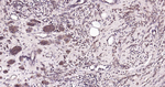 RALA Antibody in Immunohistochemistry (Paraffin) (IHC (P))