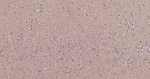RALA Antibody in Immunohistochemistry (Paraffin) (IHC (P))