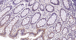 RALA Antibody in Immunohistochemistry (Paraffin) (IHC (P))