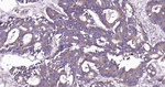 RALA Recombinant Rabbit Monoclonal Antibody (1E16)