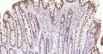 FZD8 Antibody in Immunohistochemistry (Paraffin) (IHC (P))