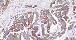 FZD8 Antibody in Immunohistochemistry (Paraffin) (IHC (P))