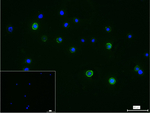 BTK Recombinant Rabbit Monoclonal Antibody (13D12)