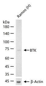 BTK Antibody in Western Blot (WB)