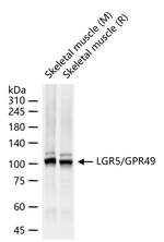 LGR5 Recombinant Rabbit Monoclonal Antibody (8H13)