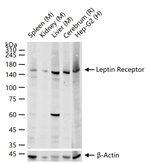 Leptin Receptor Antibody in Western Blot (WB)