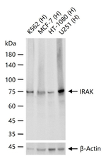 IRAK1 Recombinant Rabbit Monoclonal Antibody (15G13)
