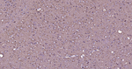 PI3K p55 gamma Antibody in Immunohistochemistry (Paraffin) (IHC (P))