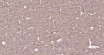 PI3K p55 gamma Antibody in Immunohistochemistry (Paraffin) (IHC (P))
