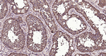 PI3K p55 gamma Antibody in Immunohistochemistry (Paraffin) (IHC (P))