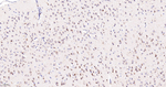 ALOX5 Antibody in Immunohistochemistry (Paraffin) (IHC (P))