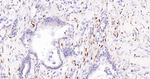 ALOX5 Recombinant Rabbit Monoclonal Antibody (18A12)