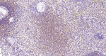ALOX5 Antibody in Immunohistochemistry (Paraffin) (IHC (P))