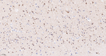 ALOX5 Antibody in Immunohistochemistry (Paraffin) (IHC (P))