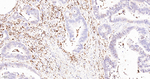ALOX5 Antibody in Immunohistochemistry (Paraffin) (IHC (P))