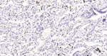 ALOX5 Antibody in Immunohistochemistry (Paraffin) (IHC (P))