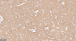 APPL1 Antibody in Immunohistochemistry (Paraffin) (IHC (P))