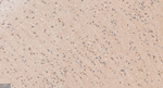 APPL1 Recombinant Rabbit Monoclonal Antibody (6F1)