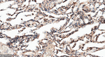APPL1 Antibody in Immunohistochemistry (Paraffin) (IHC (P))