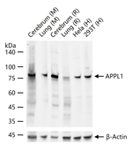 APPL1 Antibody in Western Blot (WB)