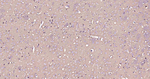 ATP1B1 Antibody in Immunohistochemistry (Paraffin) (IHC (P))