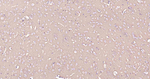ATP1B1 Antibody in Immunohistochemistry (Paraffin) (IHC (P))