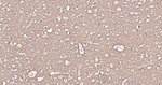 ATP1B1 Recombinant Rabbit Monoclonal Antibody (2B9)